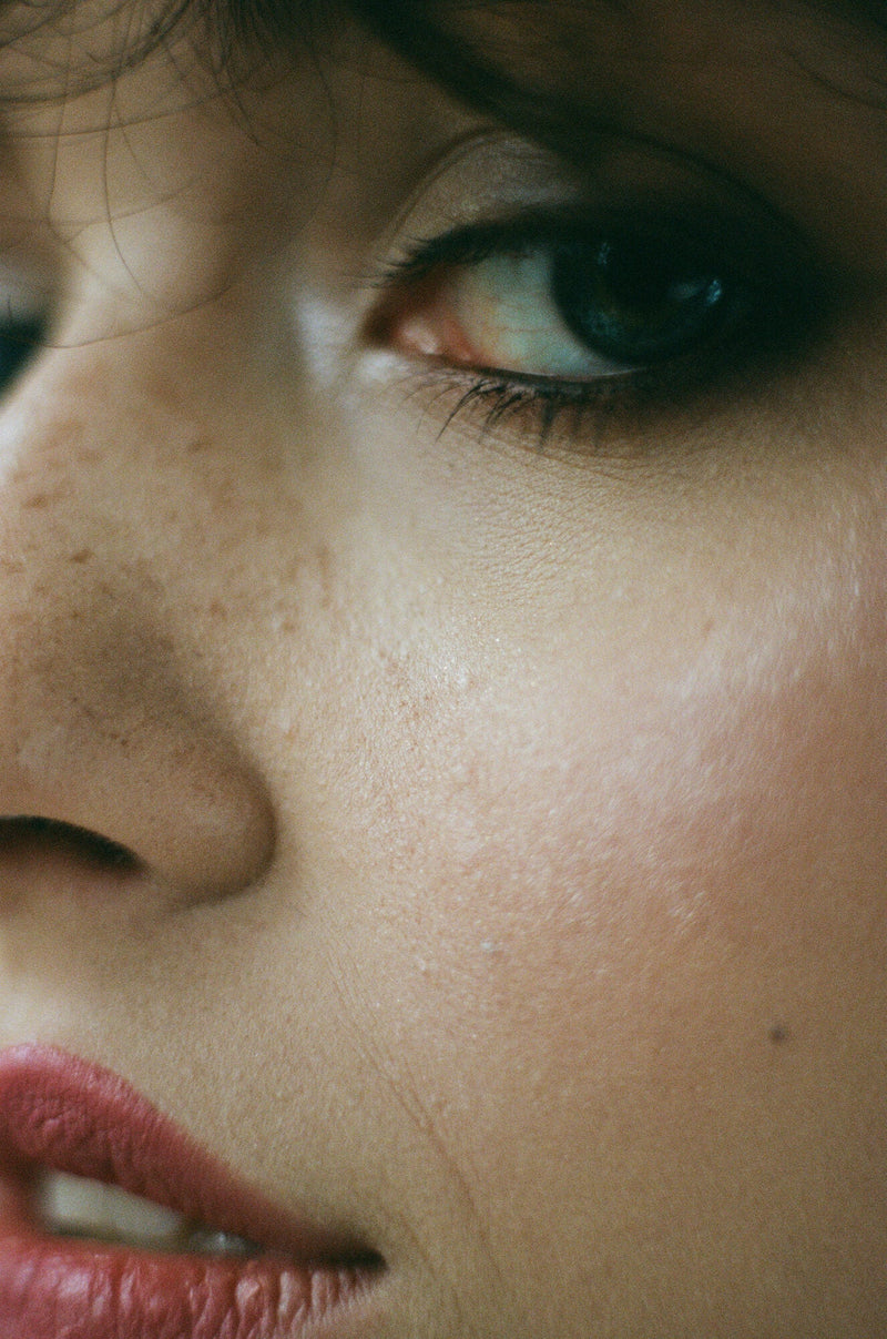 Close view of a freckled cheek in soft light, checking a spot for changes.