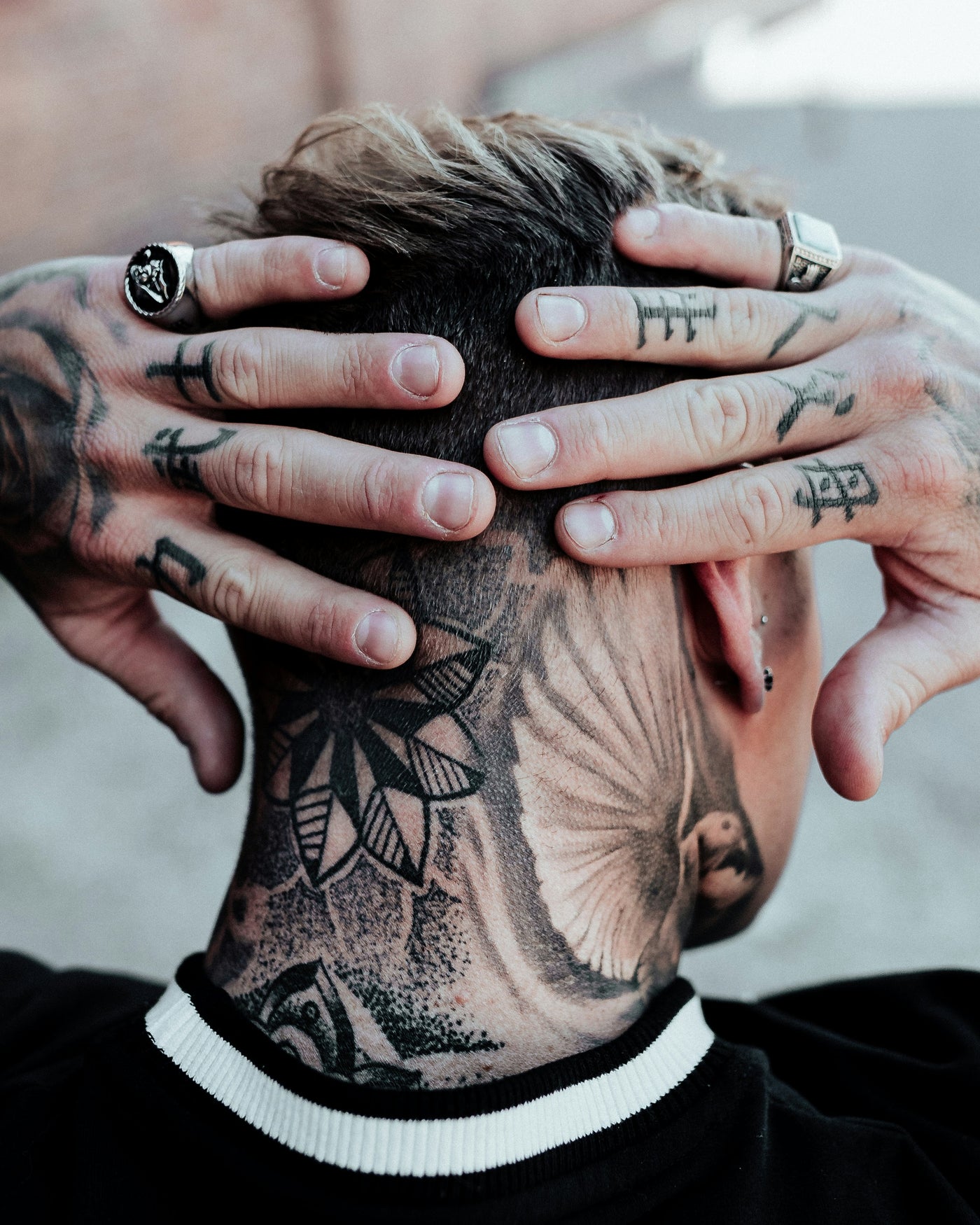 Can a Tattoo Be Removed Completely?