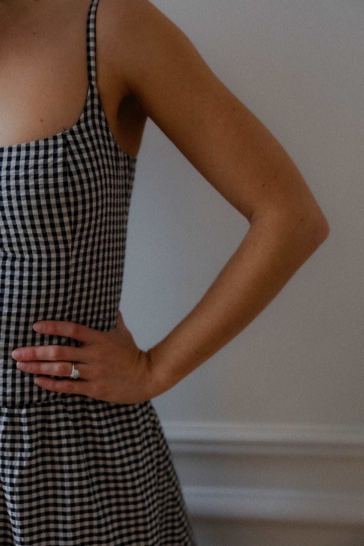 Keratosis Pilaris Treatment - What Actually Works