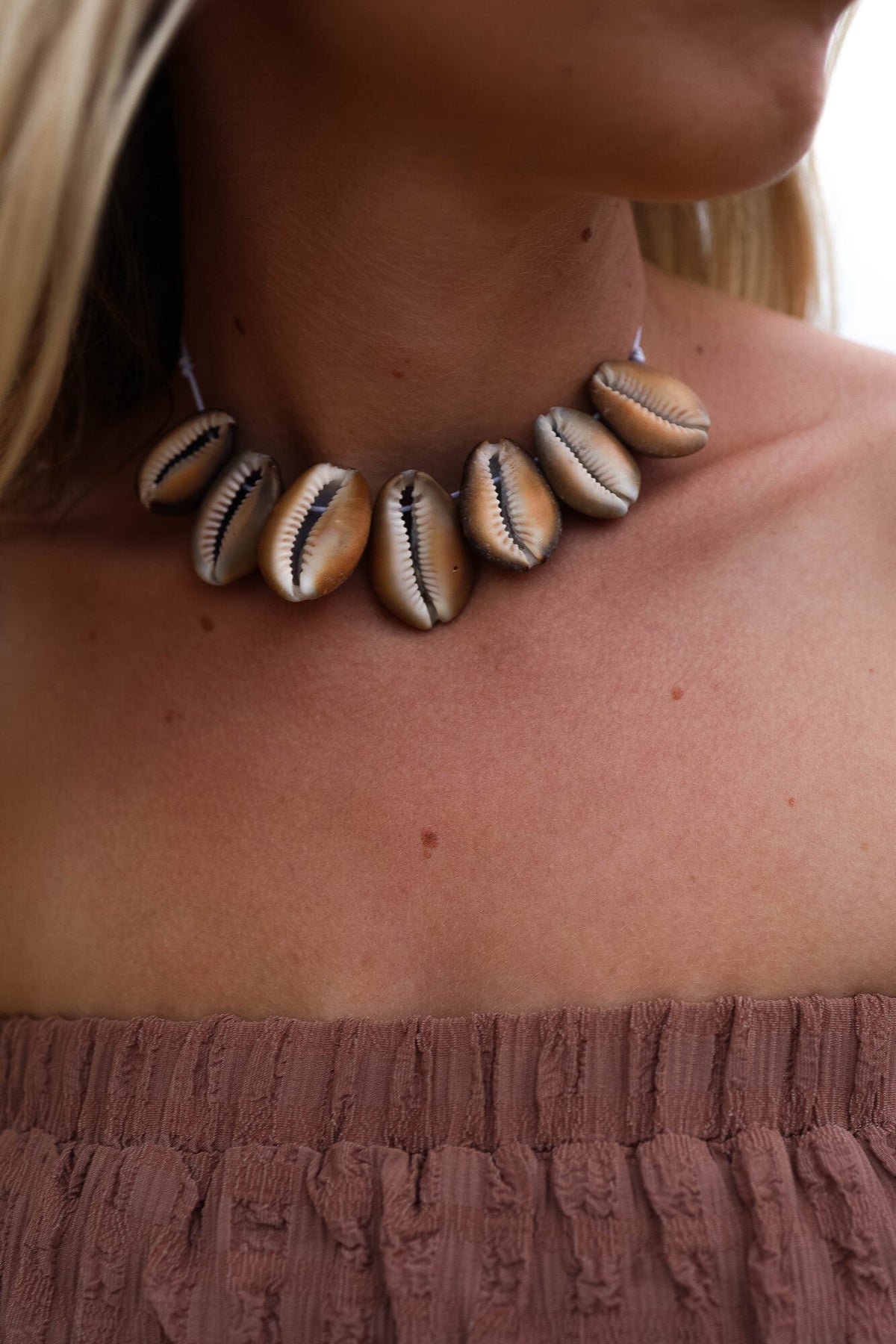 Neck and décolletage with a shell necklace, where skin tags catch on jewellery.