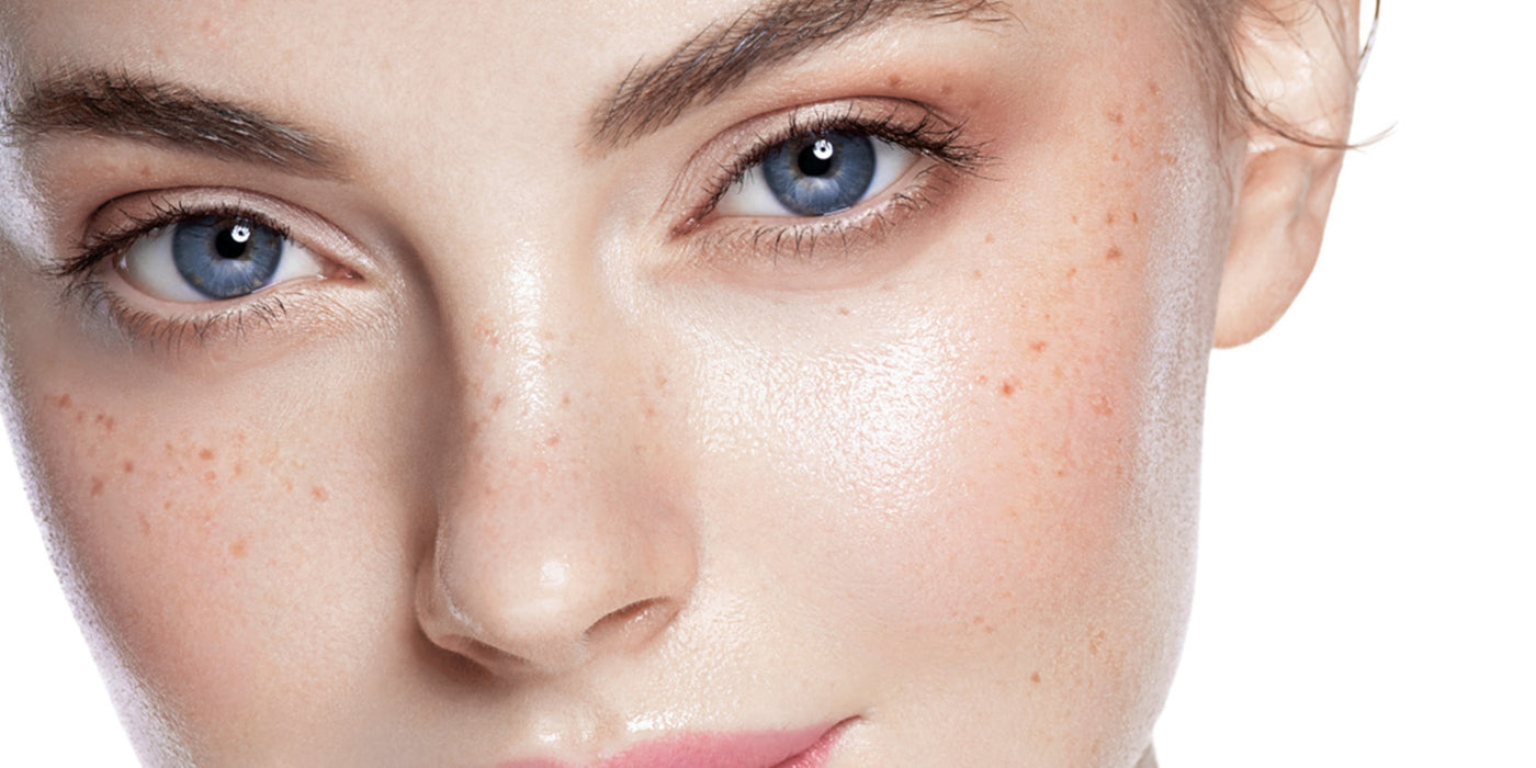 Pigmentation