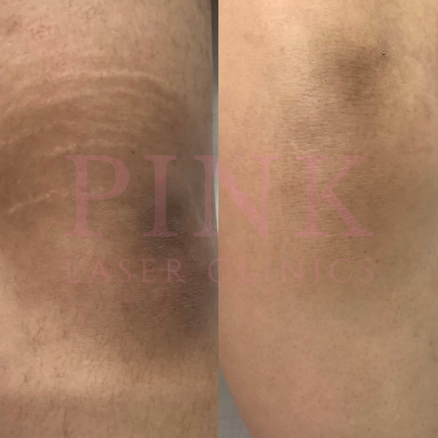 Skin Lightening & Brightening
