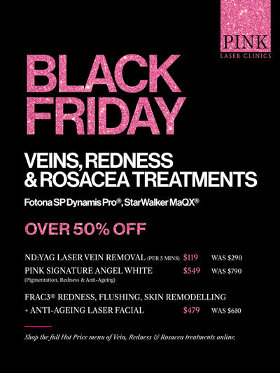 BLACK FRIDAY SALE HOT PRICE ITEMS