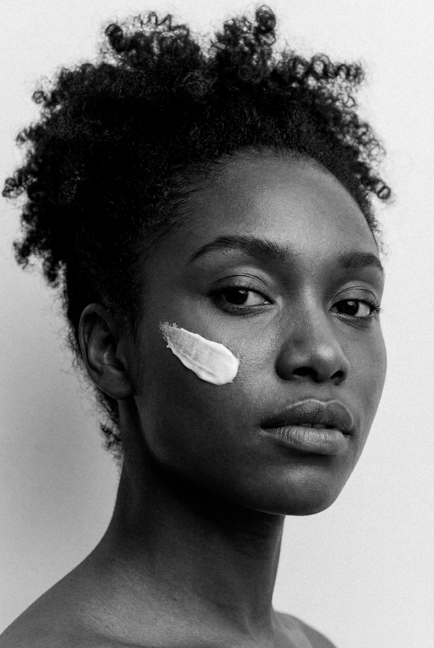 Brown marks left after acne. Why they are not scars, and what fades them