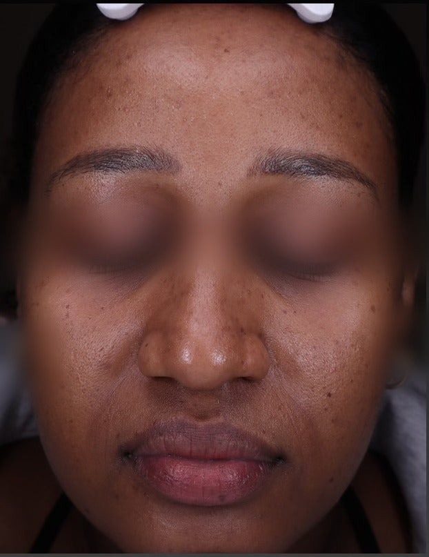 Casebook No. 001. Clinical-record photograph, eyes blurred for editorial.