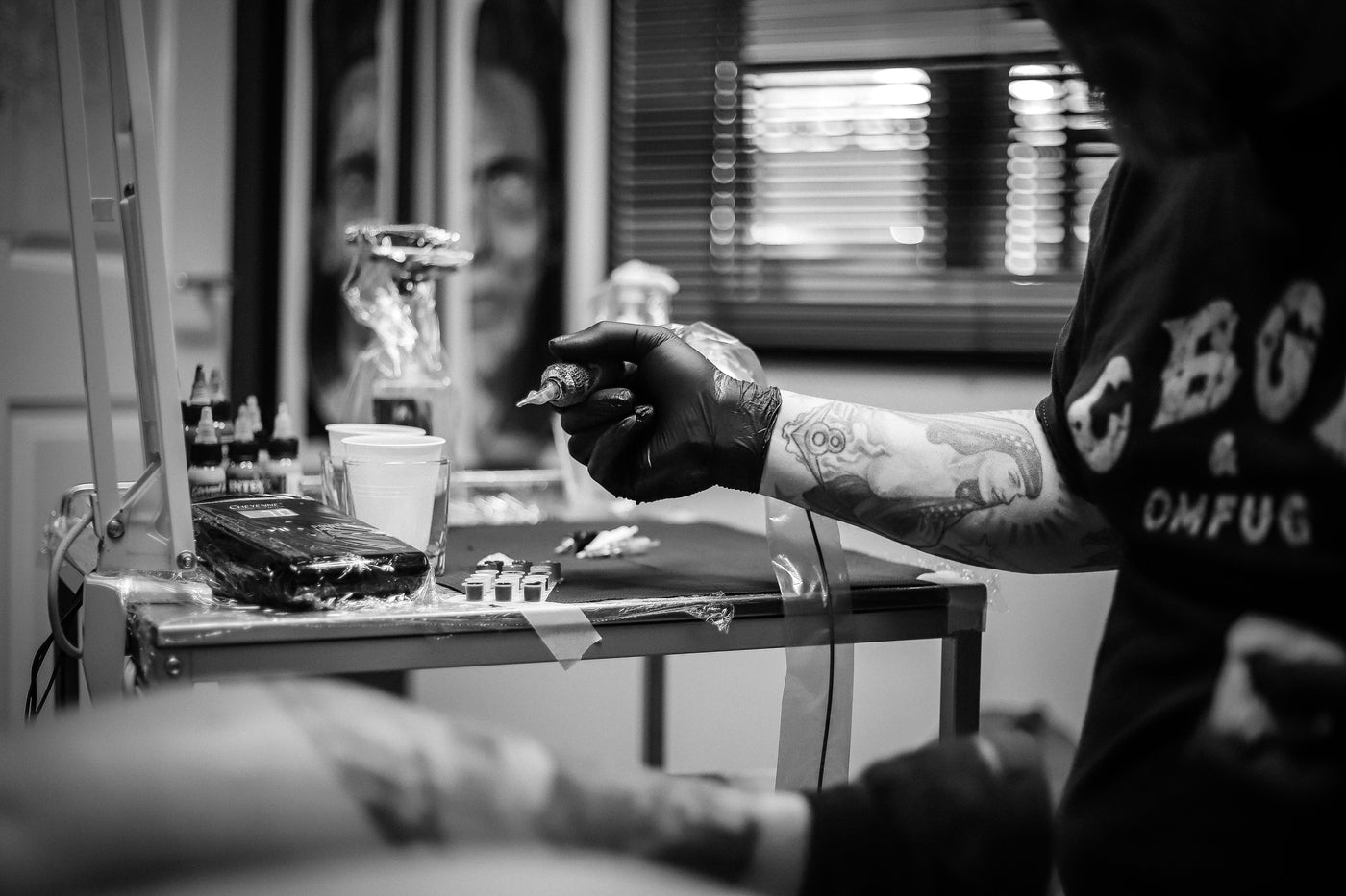 Tattoo Removal on Darker and Olive Skin