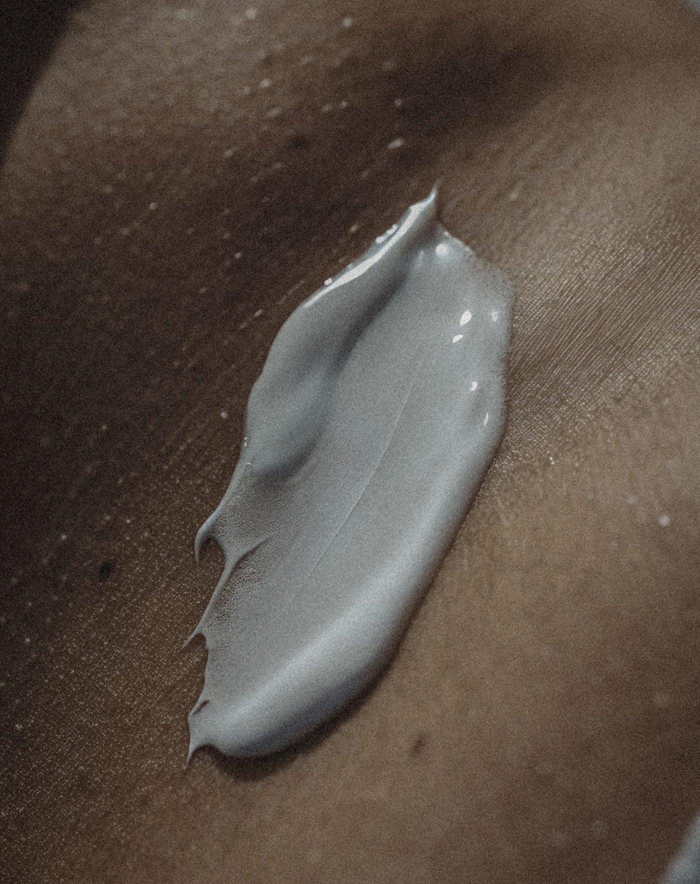 Lightening creams, or professional treatment. What a cream can and cannot do.