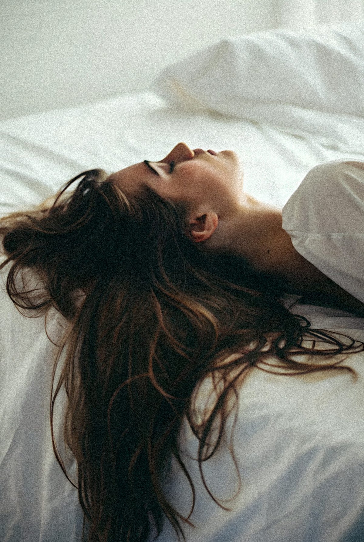 How long does acne scar treatment take, and how many sessions?