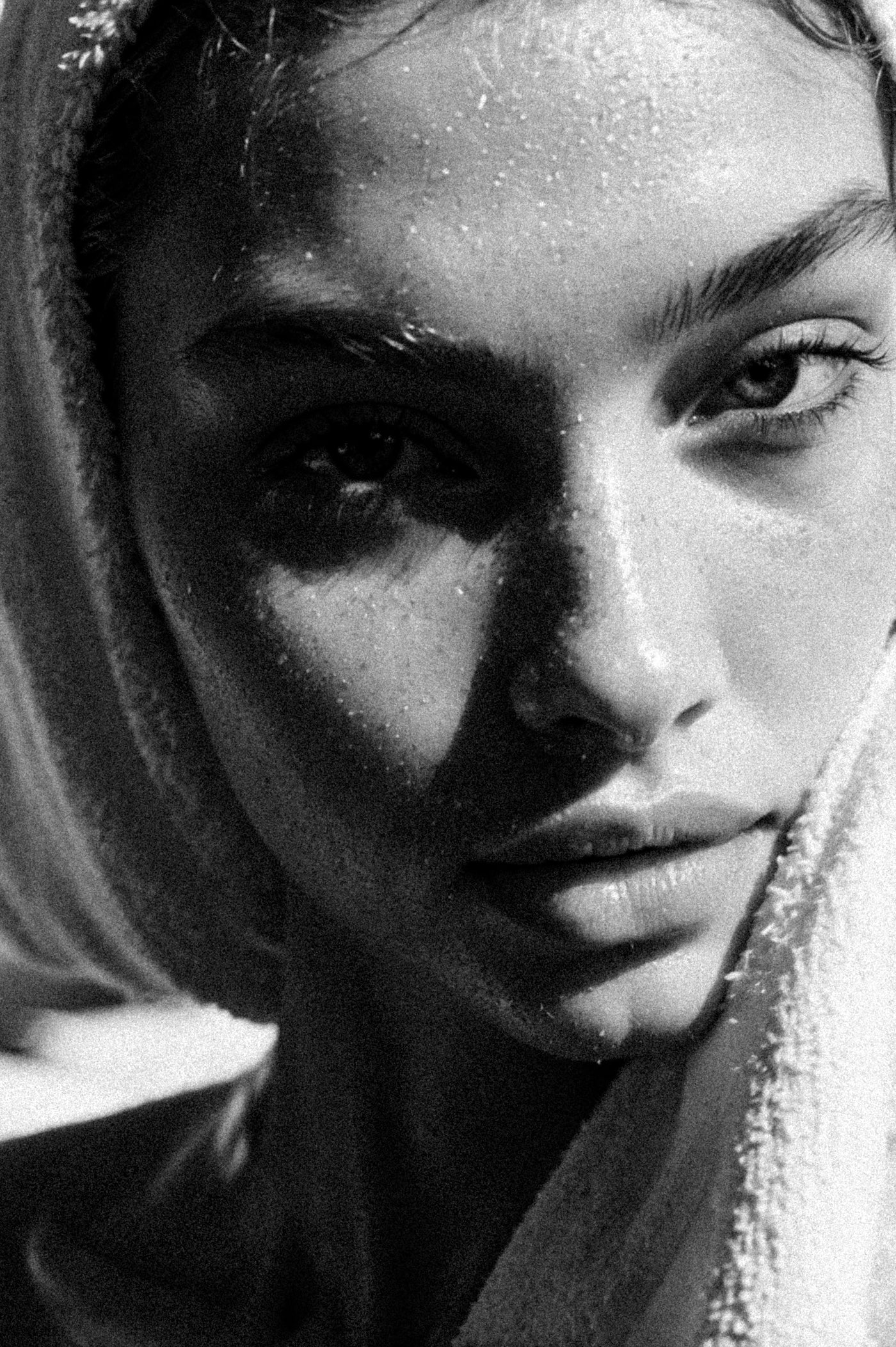 Melasma or sun damage? Why the difference changes the whole treatment