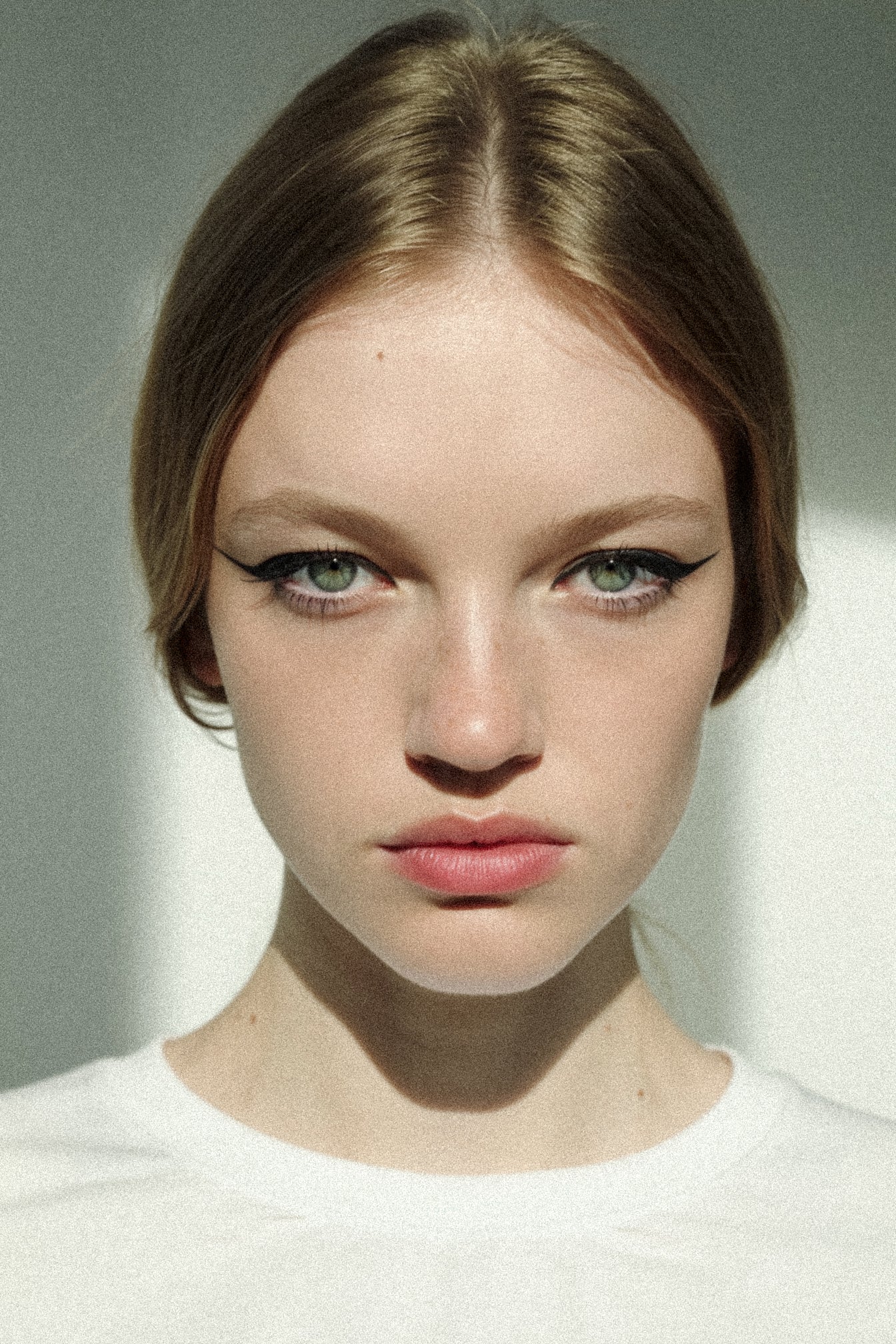 Freckles across the bridge of the nose, close-up.