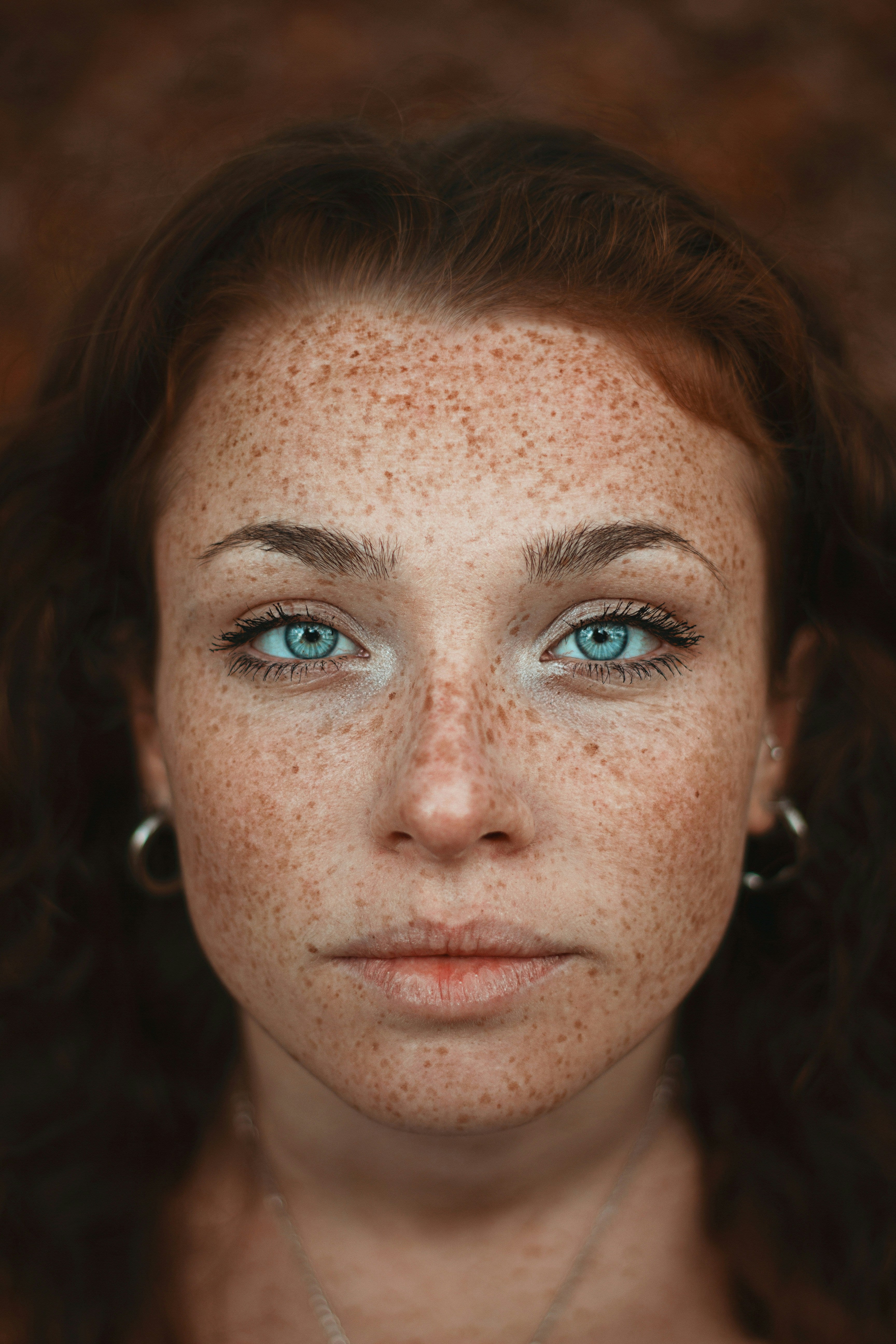 Freckles across cheeks, close-up.
