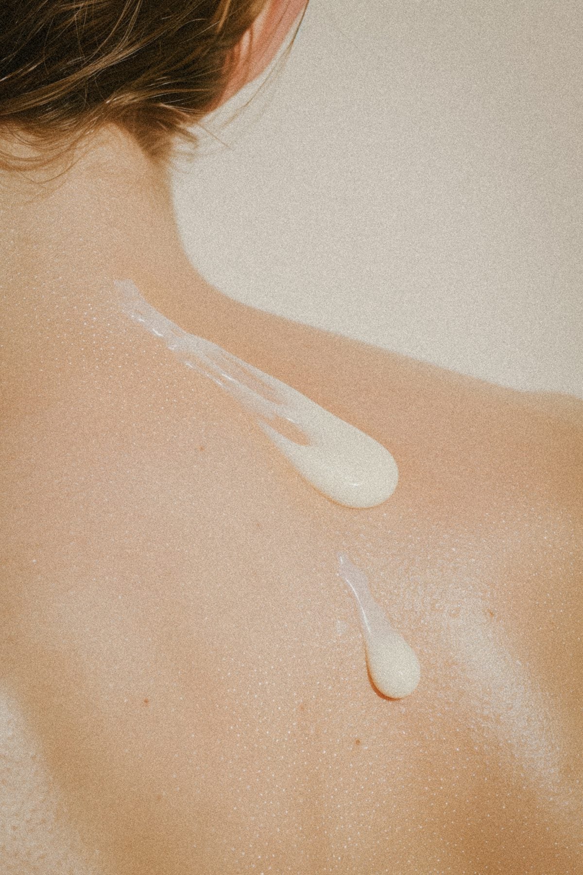 Underarm darkening. Creams, laser, and what actually shifts the colour.