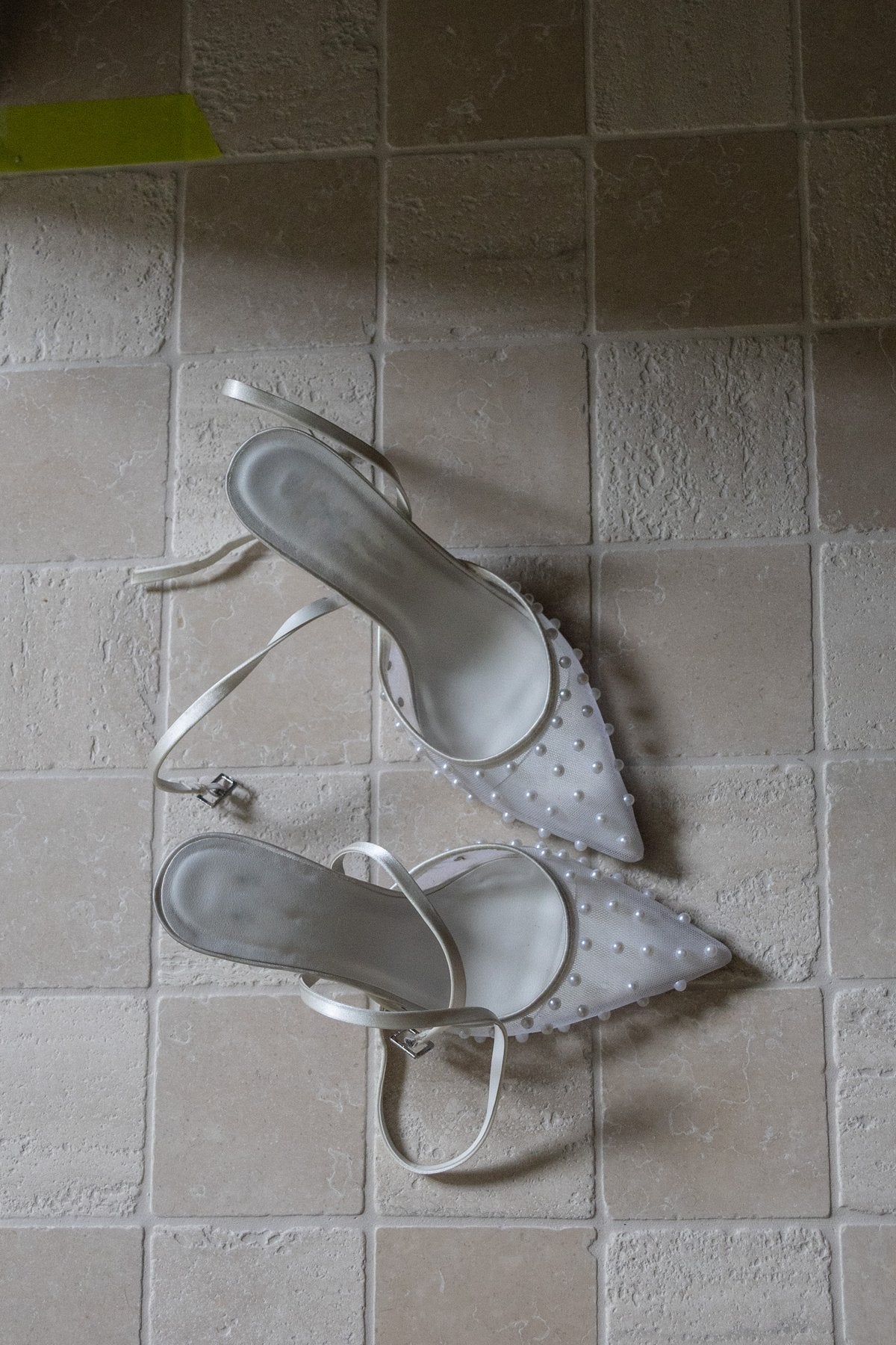 Telangiectasia Explained: Broken Capillaries, Facial Veins, Spider Naevi, Cherry Angiomas and Rosacea Vessels