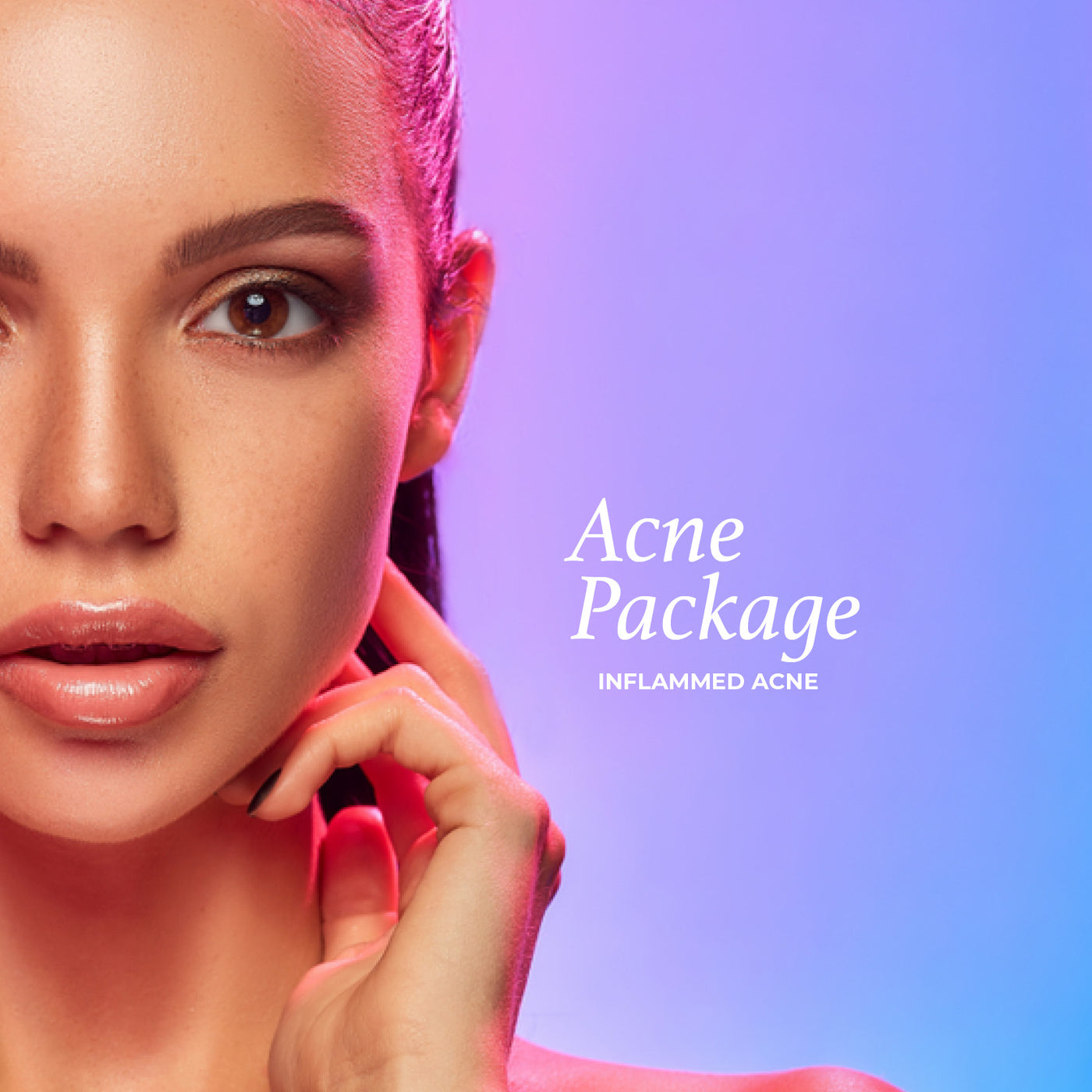Acne Package - Inflamed Acne